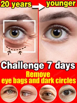 טיפול עיניים נגד קמטים קרם עיניים עיגולים כהים להסיר את שקיות עיניים עיניים נפוחות להפחית קמטים קווים עדינים, מסיר עין שמן חלקיקים